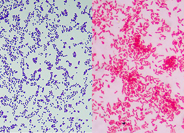 Are sterile devices microbiologically safe?